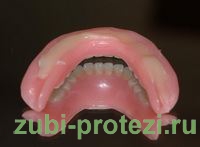 крепление зубного протеза стоматологическим клеем