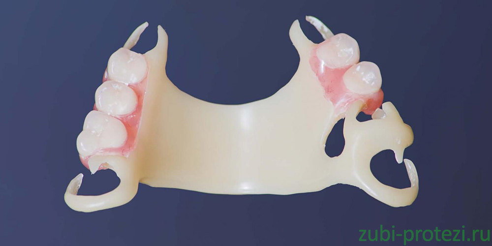 безметалловый ацеталовый зубной протез