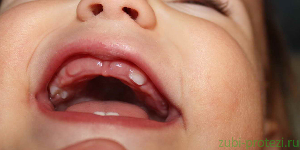 Не прорезались зубы у ребенка