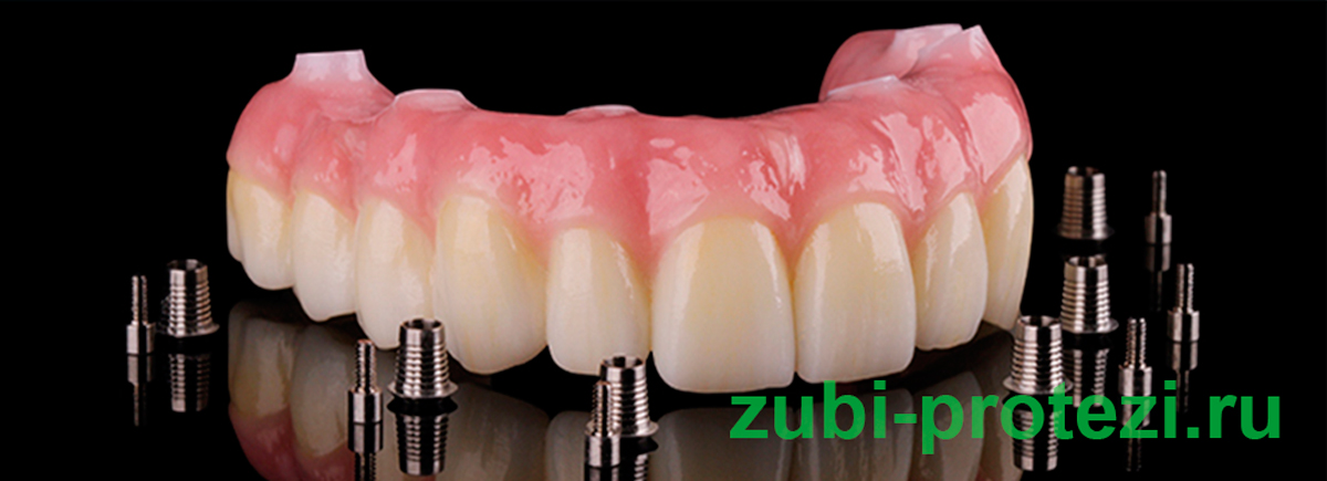 Prettau Zirconia