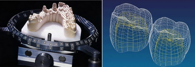 диоксид циркония cad-cam