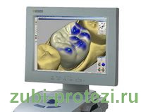 компьютерное моделирование CEREC