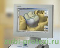 Технология CEREC в протезировании зубов