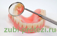 история протезирования зубов