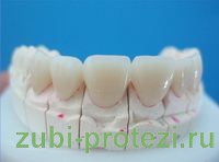 керамические зубные коронки