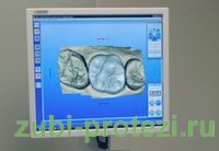 комьютерное моделирование и протезирование зубов