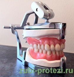 конструкция зубного протеза