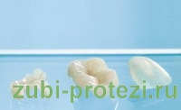 микропротезирование зубов