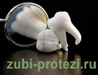 Нанотехнологии в протезировании зубов
