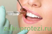 обезболивание при протезировании зубов