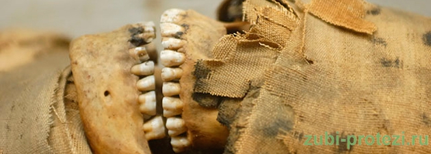 первые протезирования зубов в древности