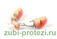 постоянные зубные протезы