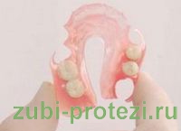 зубные протезы Акри-Фри