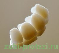 ремонт керамической зубной коронки