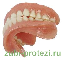 Съемные зубные протезы на имплантах