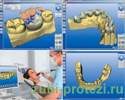 технология CAD/CAM