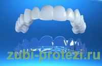 ультраниры при протезировании зубов