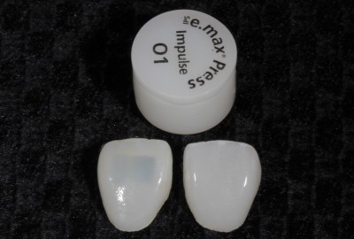керамические ультраниры на зубы