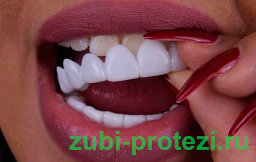 7 мифов про отбеливание зубов