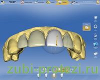 возможности компьютерного моделирования зубов