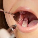 Обезболивание при протезировании зубов