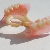 Примеры зубных протезов Квадротти