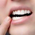 Устаревает ли протезирование зубов